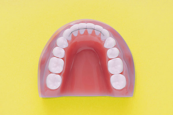 Der Retainer ist ein feiner Draht zur Fixierung der Zahnstellung